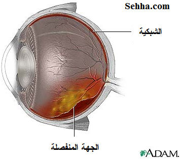 retina5.jpg