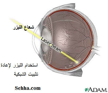 retina7.jpg