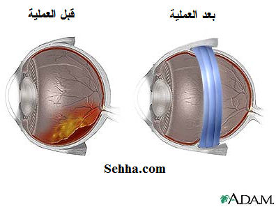 retina9.jpg