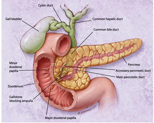    Acute pancreatitis