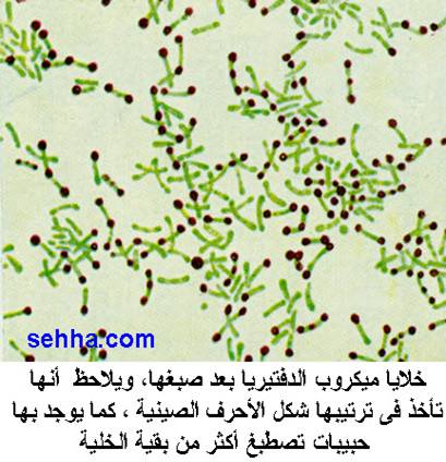 خلايا ميكروب الدفتيريا بعد صبغها