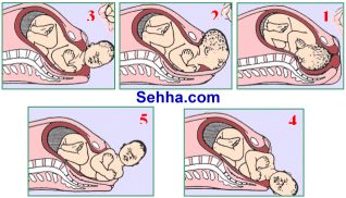 المرحلة الثانية للولادة Second stage of labor